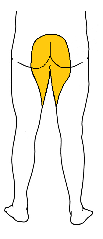 cauda equina syndrome