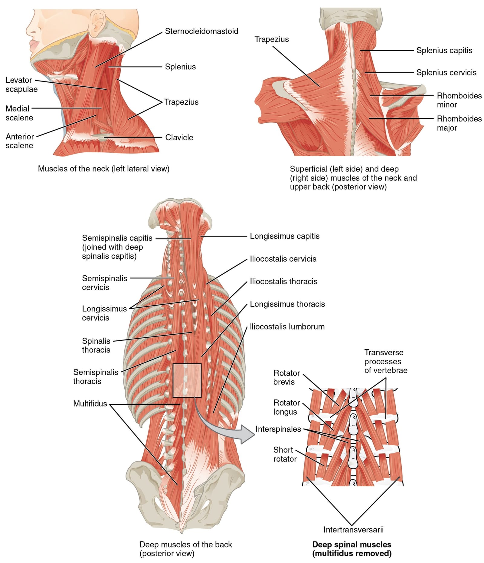 Anatomical illustration of the muscles of the neck and upper back, including the trapezius and the muscles at the base of the skull