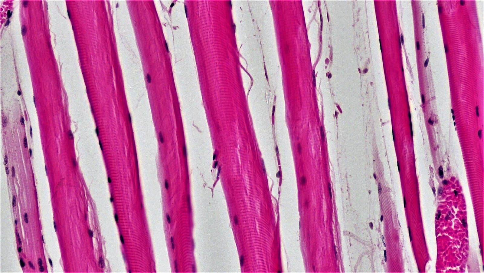 Light micrograph of stained skeletal muscle fibres showing their banded striations